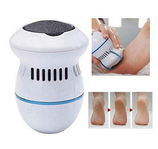 Electric Callus Remover – Professional Foot File for Smooth, Soft Heels